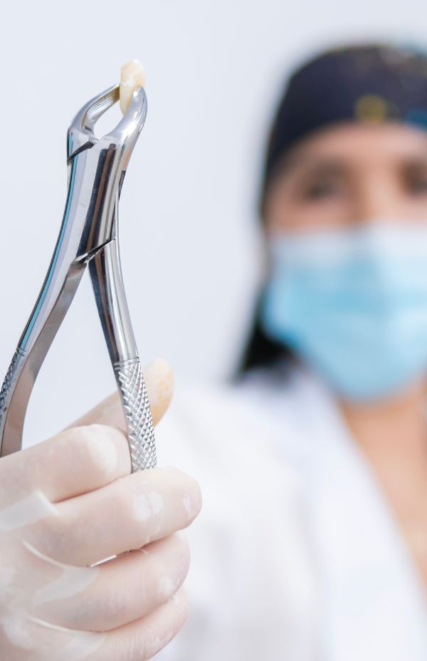 Tooth extraction