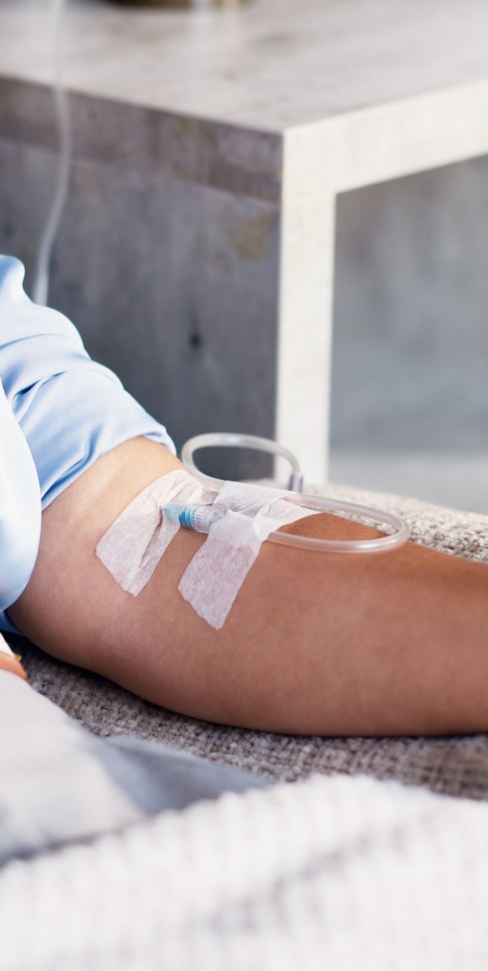 What is IV sedation