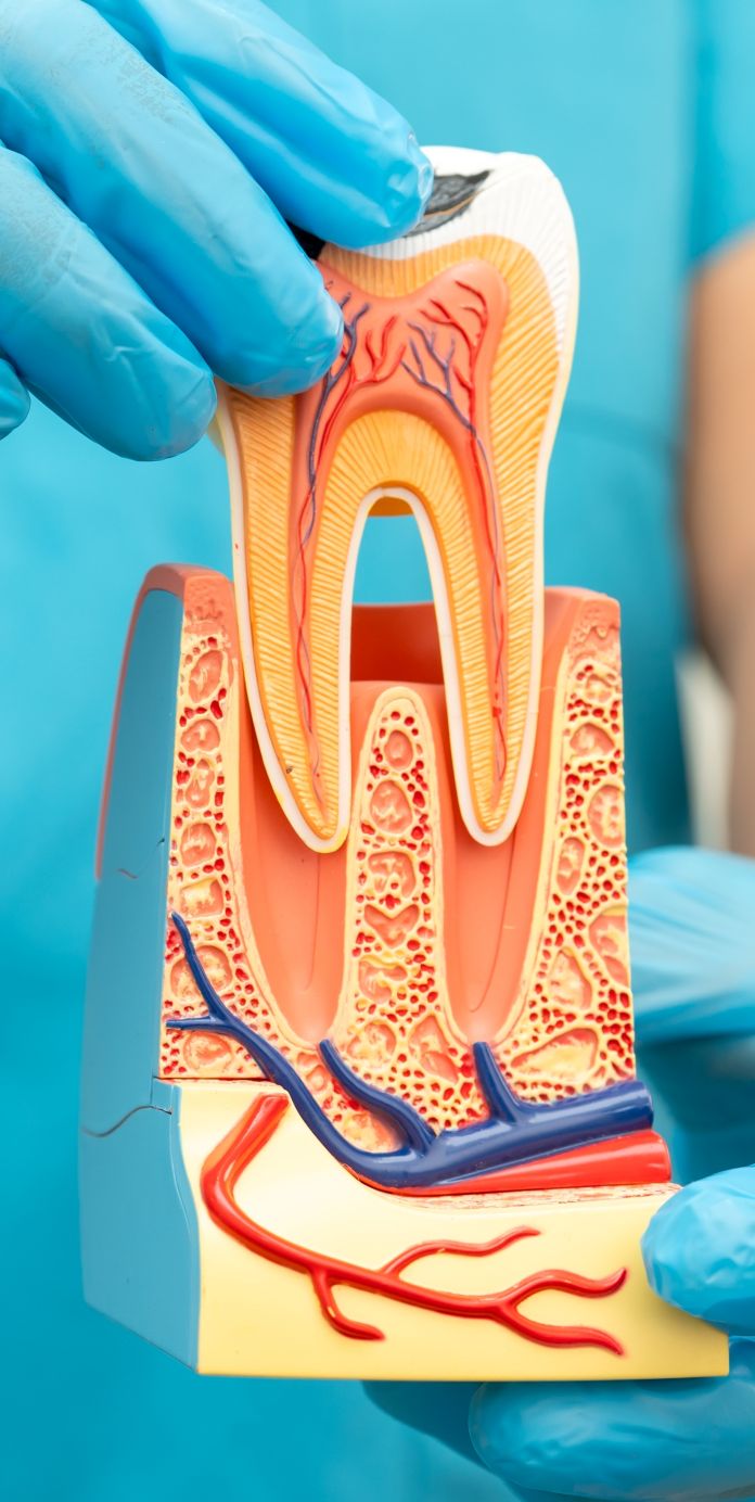 what is a root canal