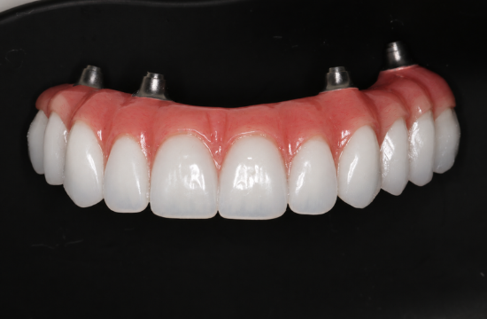 Before -Optima Dental Care