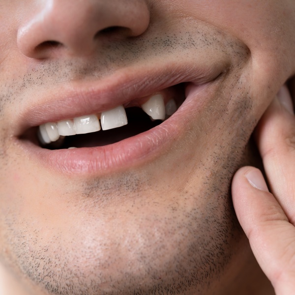 missing tooth blog